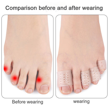 1Pair Little Toe Pinkie Foot Thumb For Daily Use Hallux Valgus Silicone Correction Gel Toe Bunion Guard Foot Care Toe Separator